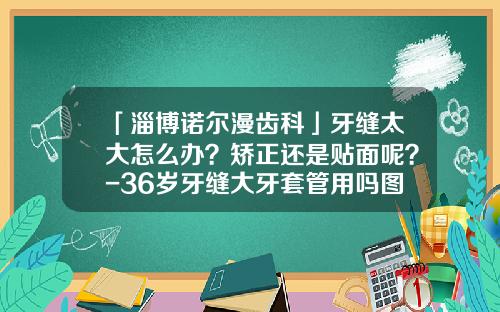 「淄博诺尔漫齿科」牙缝太大怎么办？矫正还是贴面呢？-36岁牙缝大牙套管用吗图片