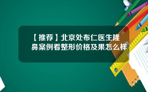 【推荐】北京处布仁医生隆鼻案例看整形价格及果怎么样