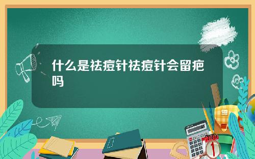 什么是祛痘针祛痘针会留疤吗