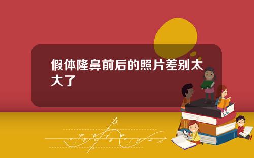 假体隆鼻前后的照片差别太大了