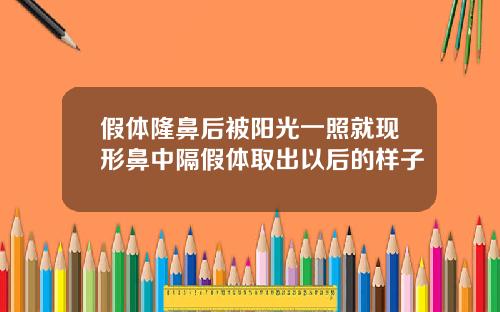 假体隆鼻后被阳光一照就现形鼻中隔假体取出以后的样子