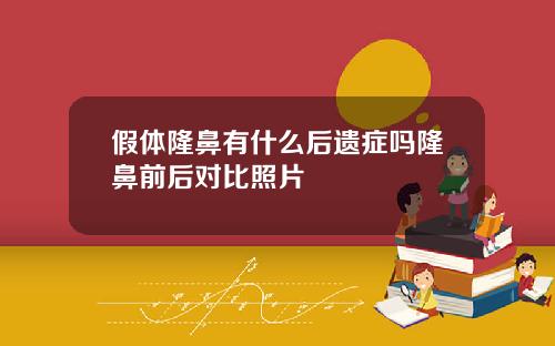 假体隆鼻有什么后遗症吗隆鼻前后对比照片