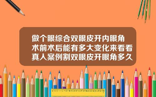 做个眼综合双眼皮开内眼角术前术后能有多大变化来看看真人案例割双眼皮开眼角多久能恢复正常