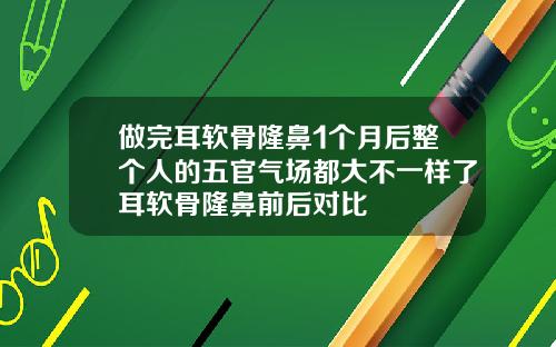 做完耳软骨隆鼻1个月后整个人的五官气场都大不一样了耳软骨隆鼻前后对比