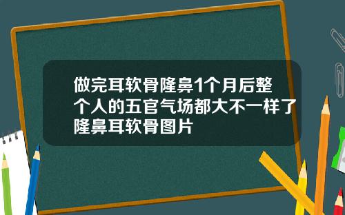 做完耳软骨隆鼻1个月后整个人的五官气场都大不一样了隆鼻耳软骨图片