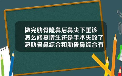 做完肋骨隆鼻后鼻尖下垂该怎么修复增生还是手术失败了超肋骨鼻综合和肋骨鼻综合有什么区别