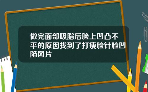 做完面部吸脂后脸上凹凸不平的原因找到了打瘦脸针脸凹陷图片