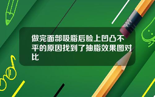 做完面部吸脂后脸上凹凸不平的原因找到了抽脂效果图对比
