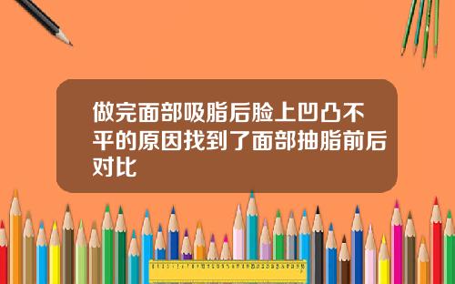 做完面部吸脂后脸上凹凸不平的原因找到了面部抽脂前后对比