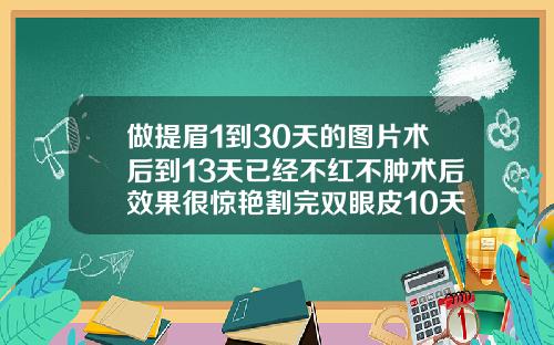 做提眉1到30天的图片术后到13天已经不红不肿术后效果很惊艳割完双眼皮10天的照片