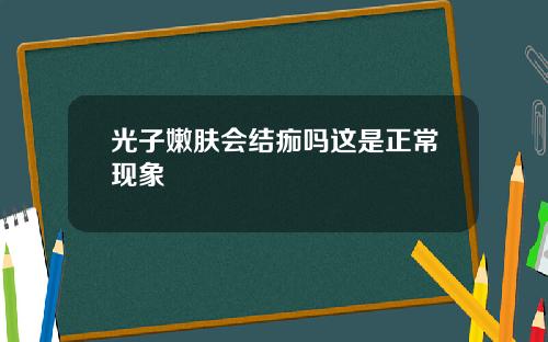 光子嫩肤会结痂吗这是正常现象