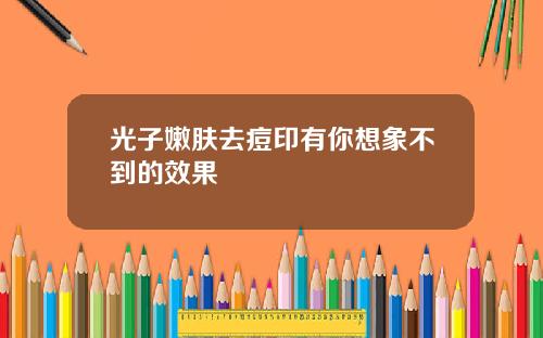 光子嫩肤去痘印有你想象不到的效果