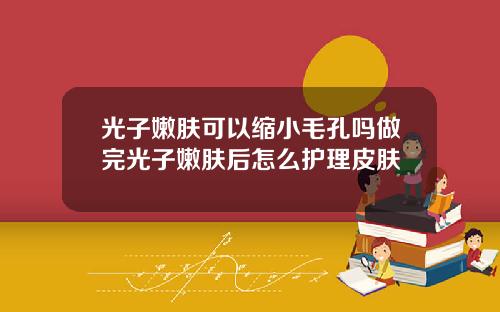 光子嫩肤可以缩小毛孔吗做完光子嫩肤后怎么护理皮肤