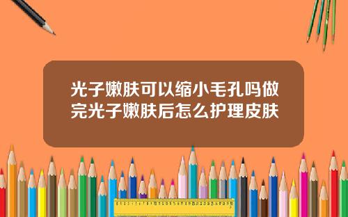 光子嫩肤可以缩小毛孔吗做完光子嫩肤后怎么护理皮肤