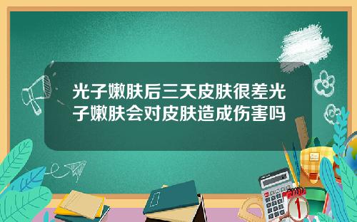 光子嫩肤后三天皮肤很差光子嫩肤会对皮肤造成伤害吗