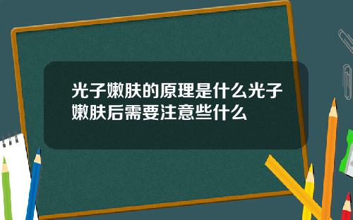 光子嫩肤的原理是什么光子嫩肤后需要注意些什么