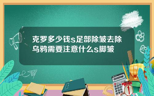 克罗多少钱s足部除皱去除乌鸦需要注意什么s脚皱