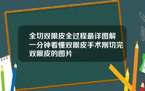 全切双眼皮全过程最详图解一分钟看懂双眼皮手术刚切完双眼皮的图片
