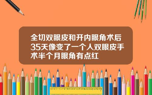 全切双眼皮和开内眼角术后35天像变了一个人双眼皮手术半个月眼角有点红