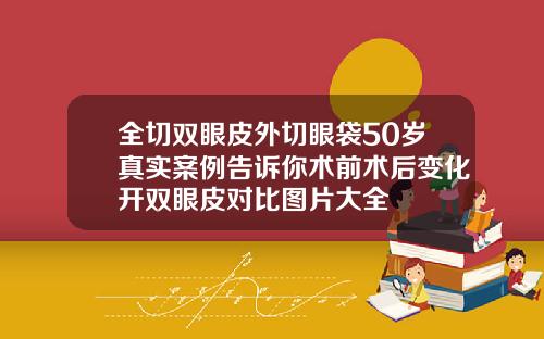 全切双眼皮外切眼袋50岁真实案例告诉你术前术后变化开双眼皮对比图片大全