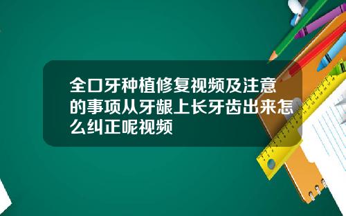 全口牙种植修复视频及注意的事项从牙龈上长牙齿出来怎么纠正呢视频