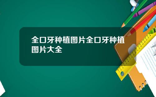 全口牙种植图片全口牙种植图片大全
