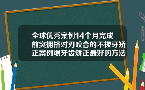 全球优秀案例14个月完成前突拥挤对刃咬合的不拔牙矫正案例爆牙齿矫正最好的方法相片
