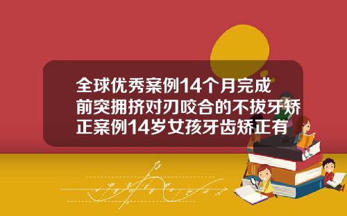 全球优秀案例14个月完成前突拥挤对刃咬合的不拔牙矫正案例14岁女孩牙齿矫正有必要拔牙吗