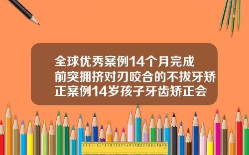 全球优秀案例14个月完成前突拥挤对刃咬合的不拔牙矫正案例14岁孩子牙齿矫正会不会影响发育