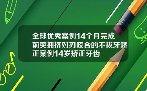 全球优秀案例14个月完成前突拥挤对刃咬合的不拔牙矫正案例14岁矫正牙齿