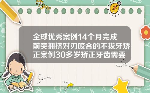 全球优秀案例14个月完成前突拥挤对刃咬合的不拔牙矫正案例30多岁矫正牙齿需要多久