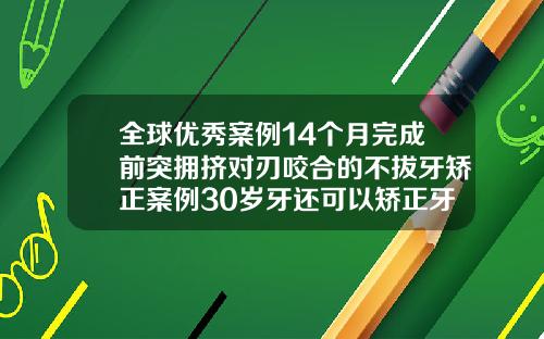 全球优秀案例14个月完成前突拥挤对刃咬合的不拔牙矫正案例30岁牙还可以矫正牙齿吗