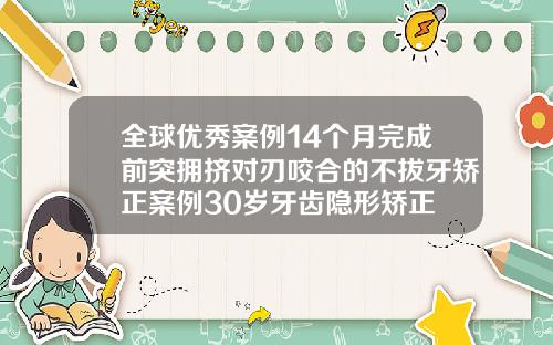 全球优秀案例14个月完成前突拥挤对刃咬合的不拔牙矫正案例30岁牙齿隐形矫正
