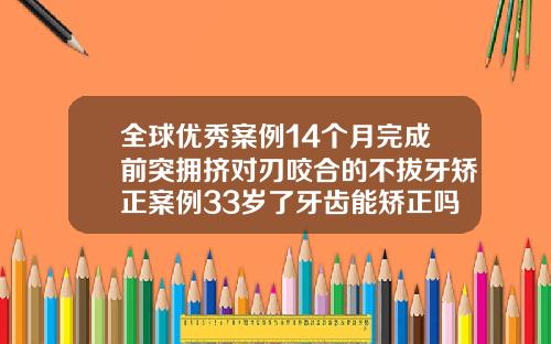 全球优秀案例14个月完成前突拥挤对刃咬合的不拔牙矫正案例33岁了牙齿能矫正吗