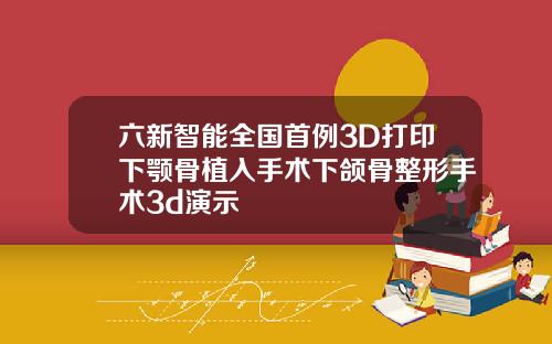 六新智能全国首例3D打印下颚骨植入手术下颌骨整形手术3d演示