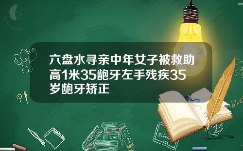六盘水寻亲中年女子被救助高1米35龅牙左手残疾35岁龅牙矫正