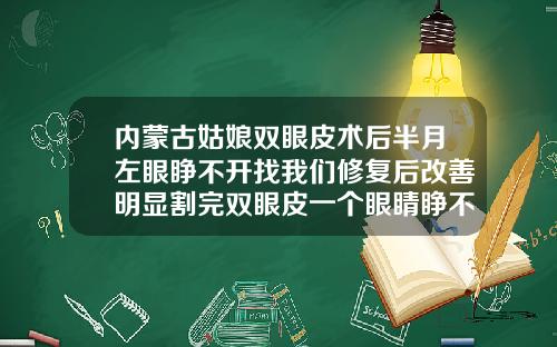 内蒙古姑娘双眼皮术后半月左眼睁不开找我们修复后改善明显割完双眼皮一个眼睛睁不开