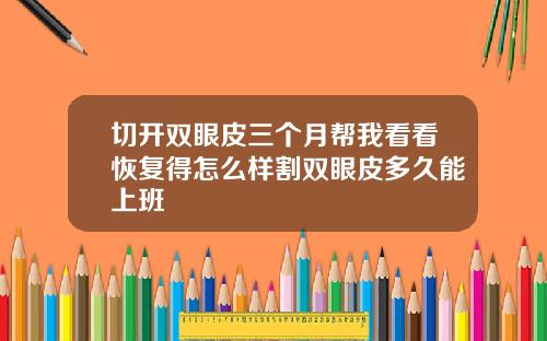 切开双眼皮三个月帮我看看恢复得怎么样割双眼皮多久能上班
