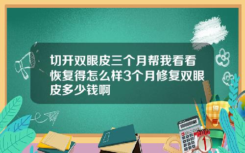 切开双眼皮三个月帮我看看恢复得怎么样3个月修复双眼皮多少钱啊