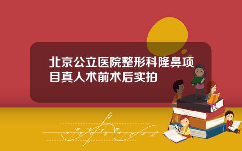 北京公立医院整形科隆鼻项目真人术前术后实拍