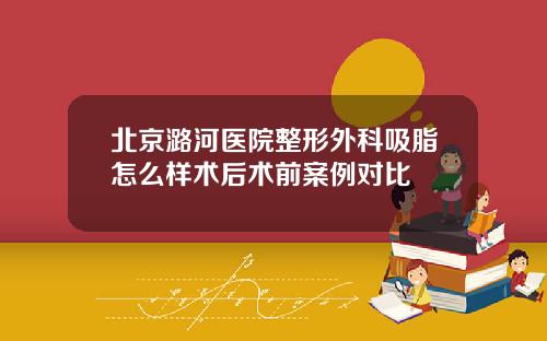 北京潞河医院整形外科吸脂怎么样术后术前案例对比