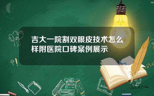吉大一院割双眼皮技术怎么样附医院口碑案例展示