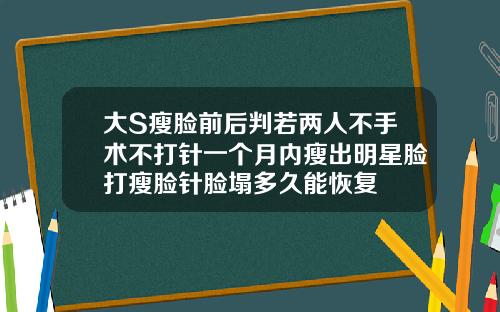 大S瘦脸前后判若两人不手术不打针一个月内瘦出明星脸打瘦脸针脸塌多久能恢复