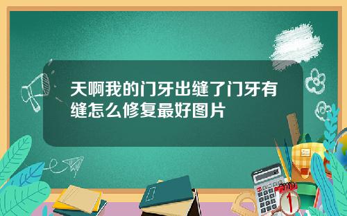 天啊我的门牙出缝了门牙有缝怎么修复最好图片
