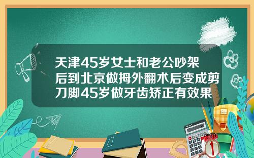 天津45岁女士和老公吵架后到北京做拇外翻术后变成剪刀脚45岁做牙齿矫正有效果吗多少钱