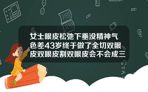 女士眼皮松弛下垂没精神气色差43岁终于做了全切双眼皮双眼皮割双眼皮会不会成三眼皮