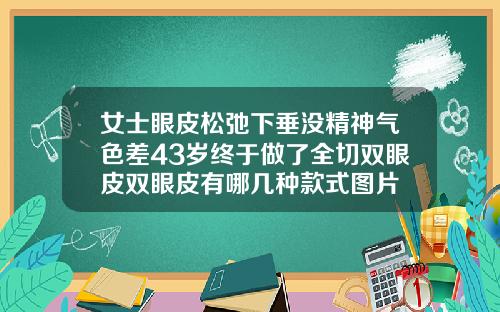 女士眼皮松弛下垂没精神气色差43岁终于做了全切双眼皮双眼皮有哪几种款式图片