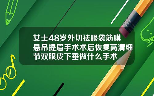 女士48岁外切祛眼袋筋膜悬吊提眉手术术后恢复高清细节双眼皮下垂做什么手术