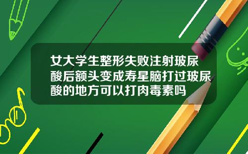 女大学生整形失败注射玻尿酸后额头变成寿星脑打过玻尿酸的地方可以打肉毒素吗