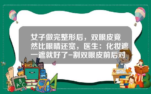 女子做完整形后，双眼皮竟然比眼睛还宽，医生：化妆遮一遮就好了-割双眼皮前后对比的图片